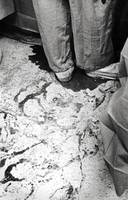 During surgery, Gift lost 6 pints of blood, some of which accumulated on the operating room floor.