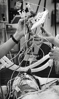 A tangle of lifelines help keep J.C. Gift alive.
