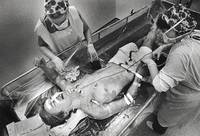 Within an hour after his arrival, nurses clean Jim Matilla's wounds and cut away burned tissue to prevent infection. 